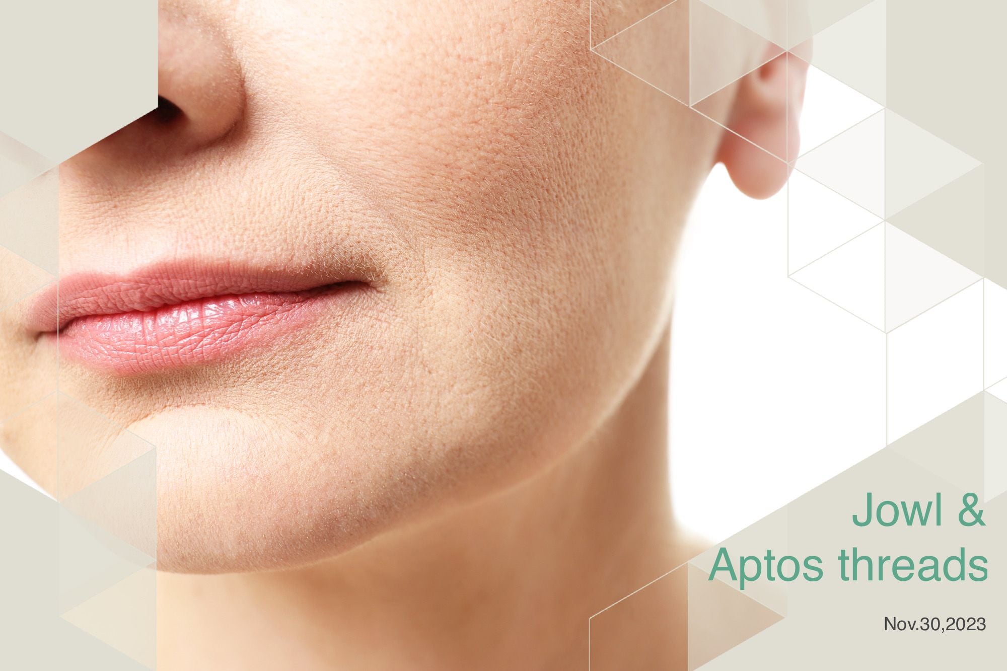 How Aptos Thread Lifting Can Improve Jowls How Aptos Thread Lifting Can Improve Jowls
